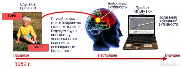 Мозг Схема записи образа 6